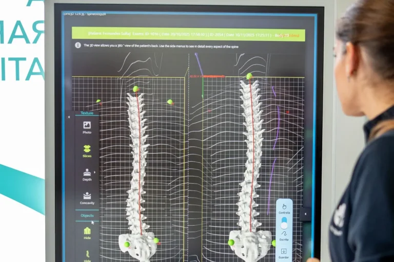 Fisiorestelo-reeducao-postura-global Avaliação 3D da coluna utilizada na Reeducação Postural Global para análise postural individualizada