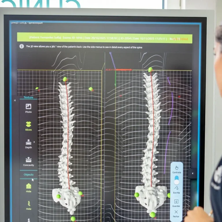 Fisiorestelo-reeducao-postura-global Avaliação 3D da coluna utilizada na Reeducação Postural Global para análise postural individualizada