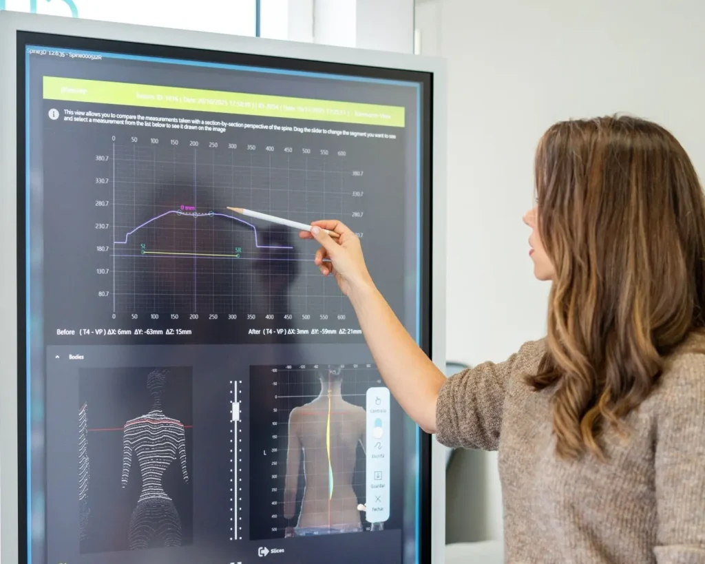 Fisioterapeuta a analisar avaliação postural 3D da coluna durante consulta de RPG em Lisboa