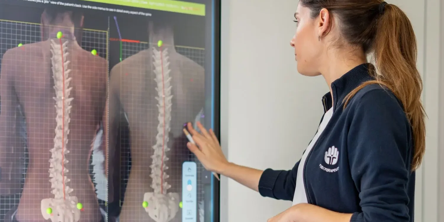 analise-postural-escoliose-schroth-rpg Fisioterapeuta a analisar o alinhamento da coluna vertebral através de tecnologia de avaliação postural