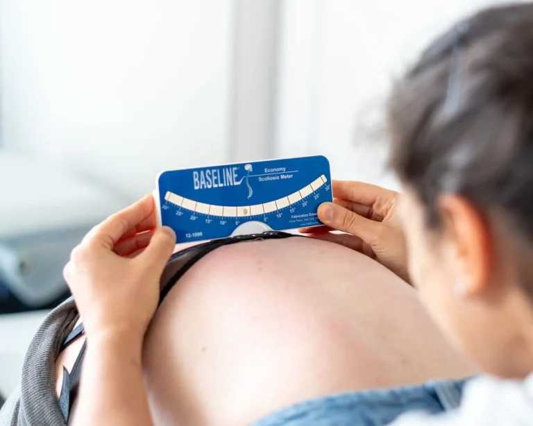 Fisioterapeuta a realizar avaliação da coluna com escoliómetro em adulto com escoliose