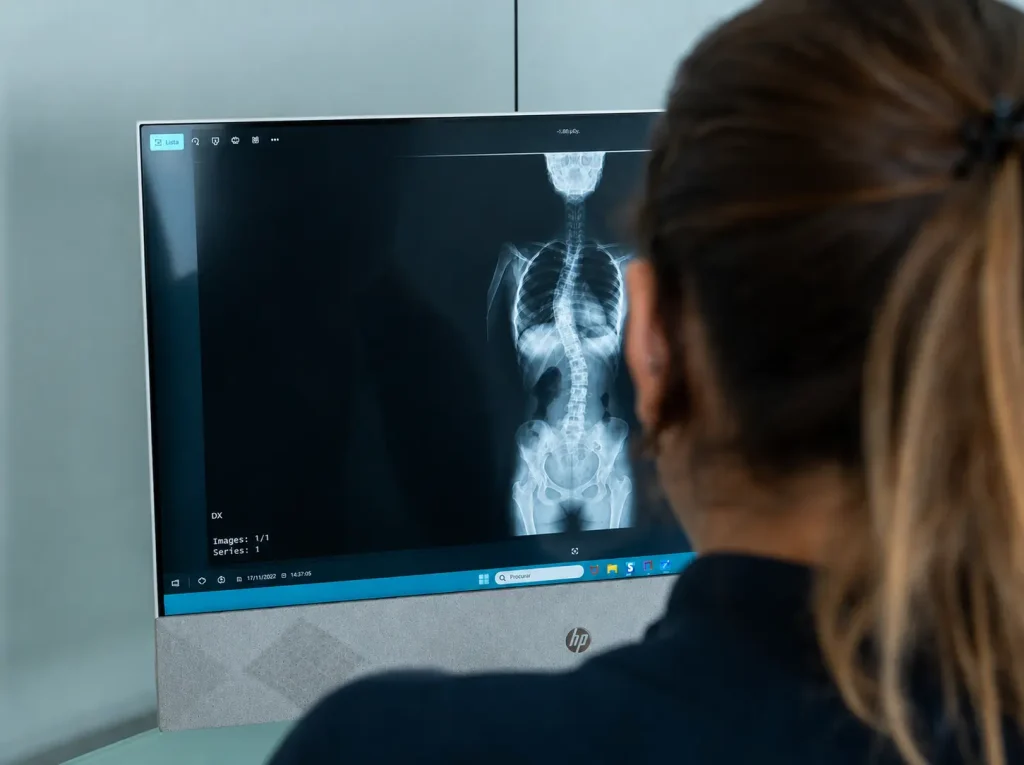 Fisioterapeuta a analisar radiografia de adulto com escoliose durante avaliação especializada da coluna