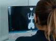 Fisioterapeuta a analisar radiografia de adulto com escoliose durante avaliação especializada da coluna