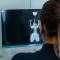 Fisioterapeuta a analisar radiografia de adulto com escoliose durante avaliação especializada da coluna
