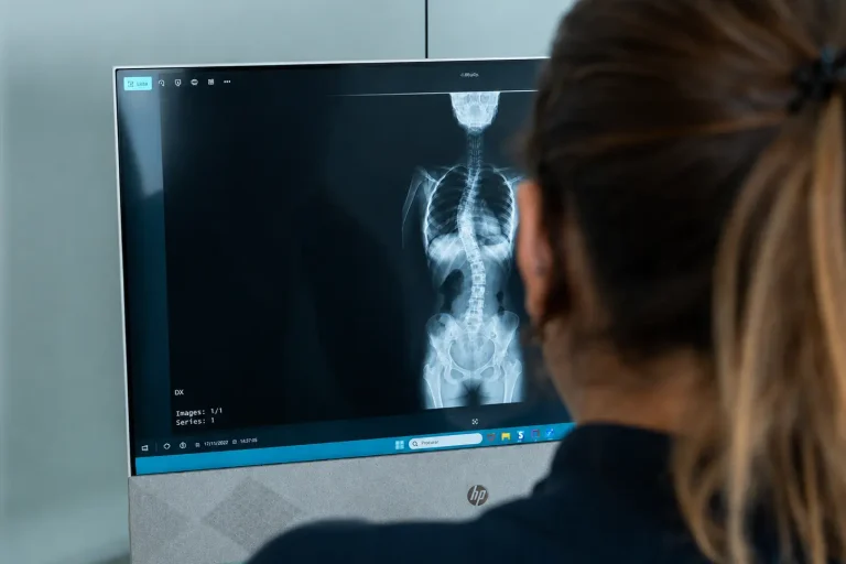escoliose-em-adultos-avaliacao-especializada-coluna Fisioterapeuta a analisar radiografia de adulto com escoliose durante avaliação especializada da coluna